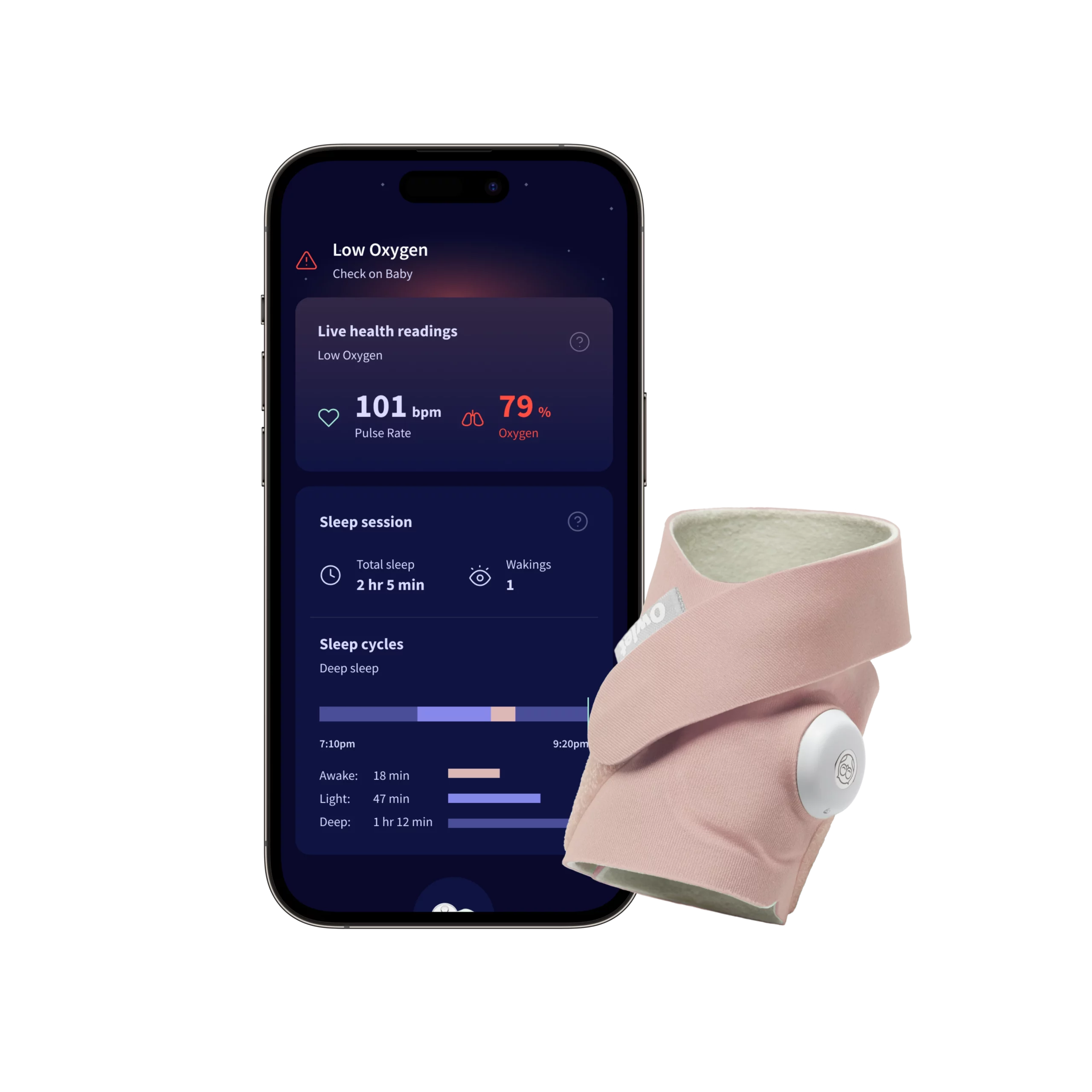 Owlet Dream Sock™ Akıllı Çorap - 0-18 ay (Gül Kurusu)